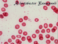 Acinetobacter baumannii