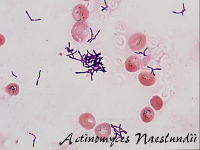 Actinomyces naeslundii