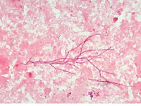 Actinomyces spp