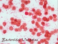 Bacteroides vulgatus