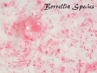 Borrelia spp