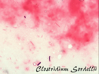 Clostridium sordellii