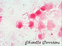 Eikenella corrodens