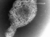 Paramyxovirus (2)