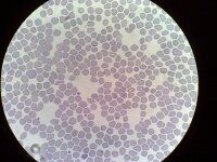 Plasmodium falciparum