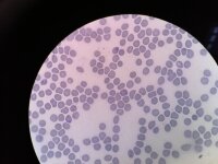 Plasmodium falciparum