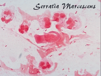 Serratia marcescens