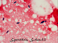 Sporothrix schenckii