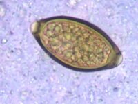 Trichuris trichiura